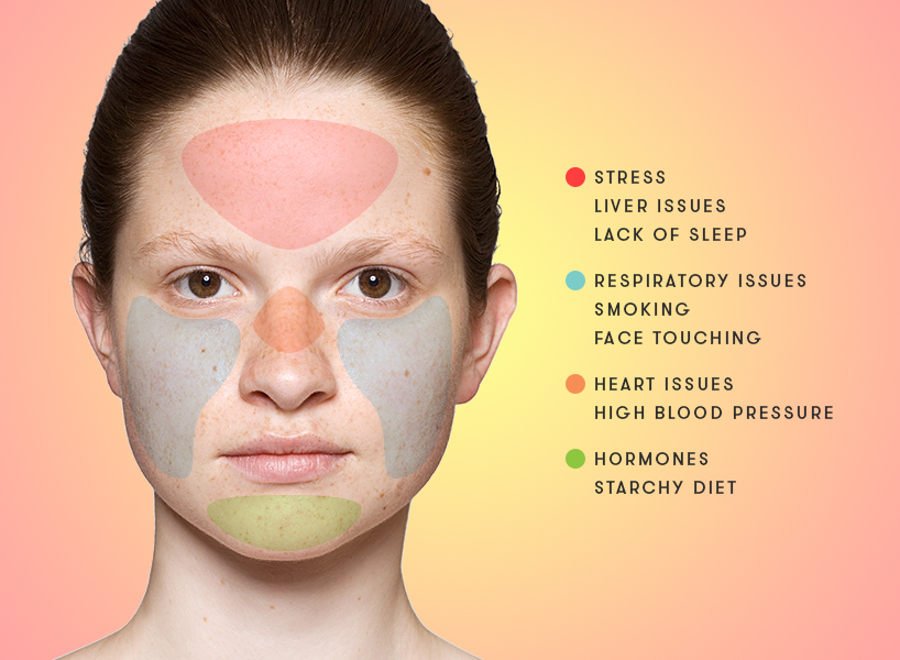 4 things your acne is really trying to tell you ...